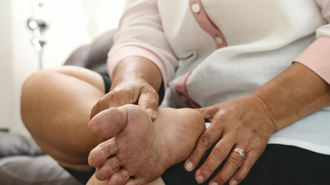 The Connection Between Diabetic Peripheral Neuropathy and Balance Issues